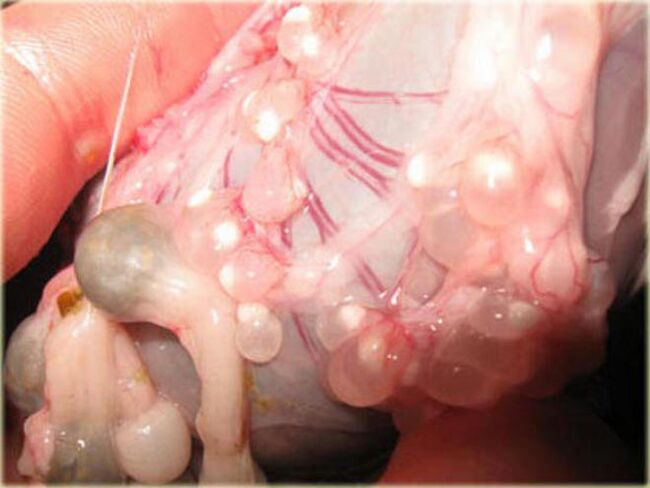 Larvas de cisticerco sob a pele