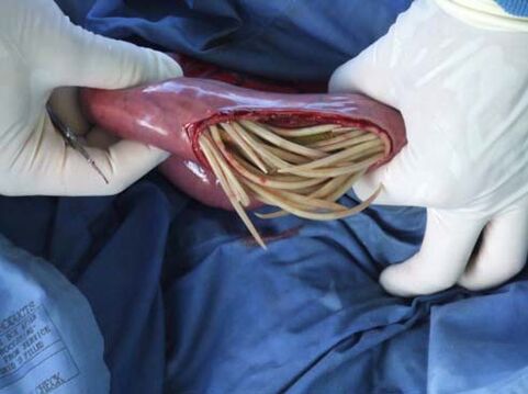 parasitas nos intestinos